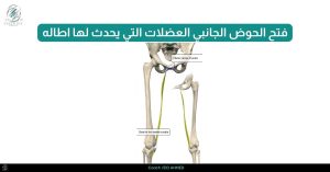 _فتح الحوض الجانبي العضلات التي يحدث لها اطاله ٢