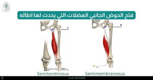 _فتح الحوض الجانبي العضلات التي يحدث لها اطاله ٣