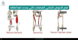 _فتح الحوض الجانبي العضلات التي يحدث لها اطاله ٤