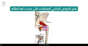 _فتح الحوض الجانبي العضلات التي يحدث لها اطاله ٧