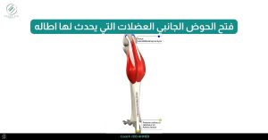 _فتح الحوض الجانبي العضلات التي يحدث لها اطاله ٩